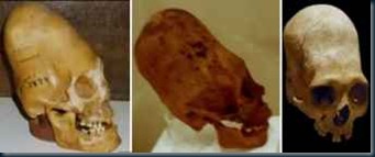 Cranios Alongados Alien Peruanos Cranios Alongados Alien Peruanos os crânios alongados.