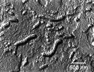 Vida Microbiana Antartida Vida Microbiana Antartida fóssil de tartaruga, encontrado na antartida, datado em 90 milhões de anos.